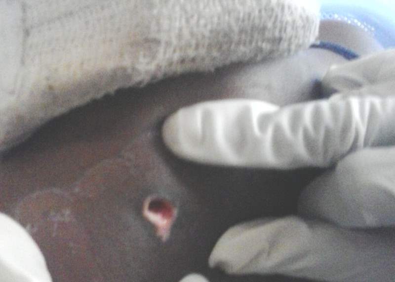 249211-photo-7-bullet-in-the-neck